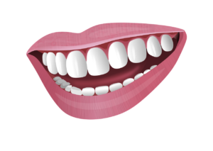 access-dental-pddc-teeth